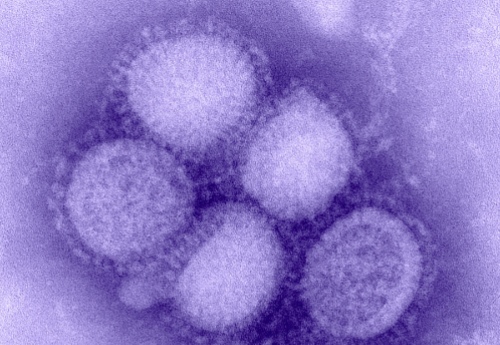 h1n1_influenza_virus.jpeg